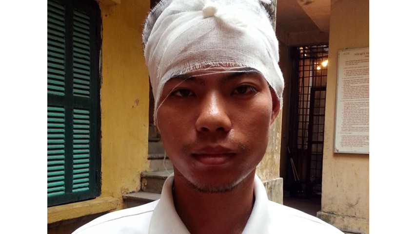 Bằng có tiền sử bệnh tâm thần phân liệt. Ảnh: Việt Đức.