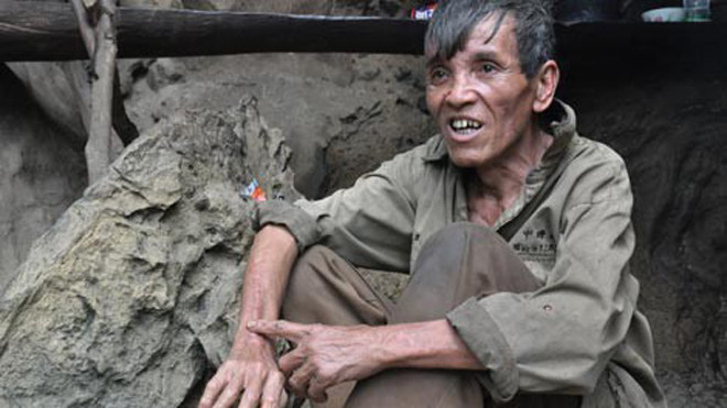 Ông Toán chỉ vào vết sẹo trong lần bị rắn cắn. 