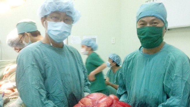 Khối u 11 kg lấy khỏi ổ bụng bệnh nhân sáng 21/5. Ảnh: Đ.X.