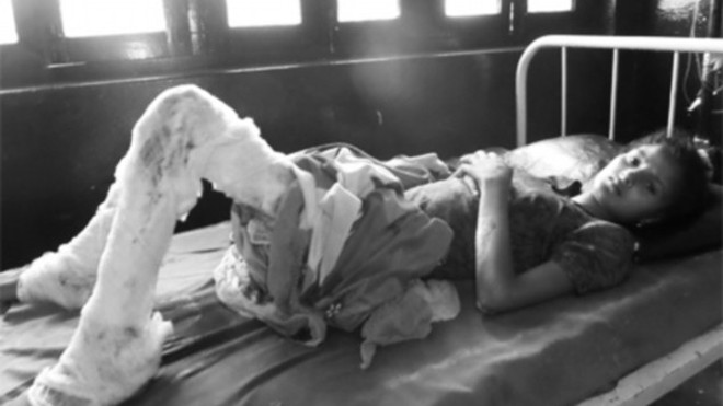 Cô gái đáng thương bị chồng thiêu sống 