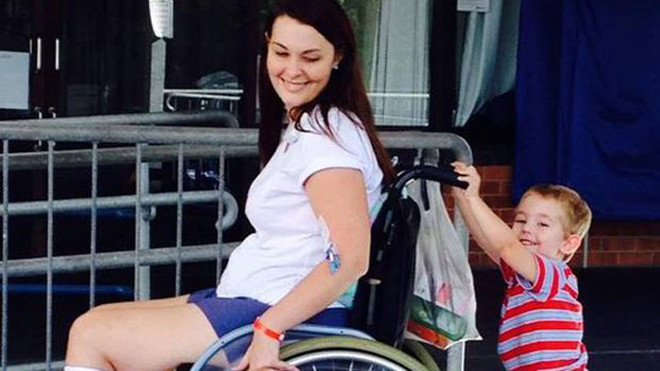 Jo Gilchrist bị liệt sau khi dùng chung cọ trang điểm với người bạn thân. Ảnh: Independent