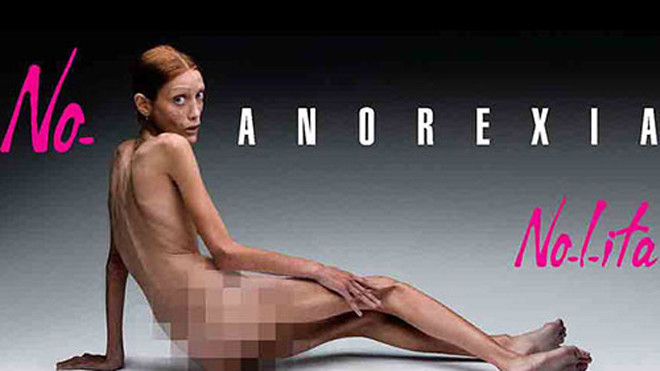 Khi mẫu siêu gầy Isabelle Caro ý thức được vấn đề sức khỏe của bản thân thì cô đã không qua khỏi, chết trong khi chụp ảnh quảng cáo cho chiến dịch nâng cao nhận thức về chứng biếng ăn Ảnh: REUTERS