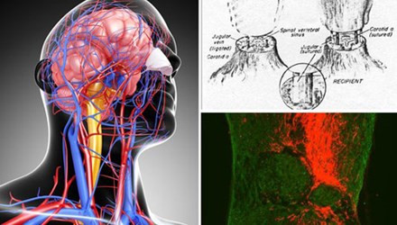 Sẽ ghép đầu người trong năm 2016?