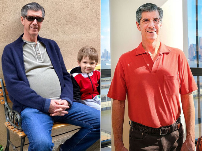 Ông Daly trước và sau phẫu thuật cắt bỏ khối u. 