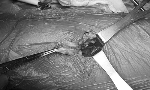 Bác sĩ mổ nối gân cho bệnh nhân. Ảnh: X.A