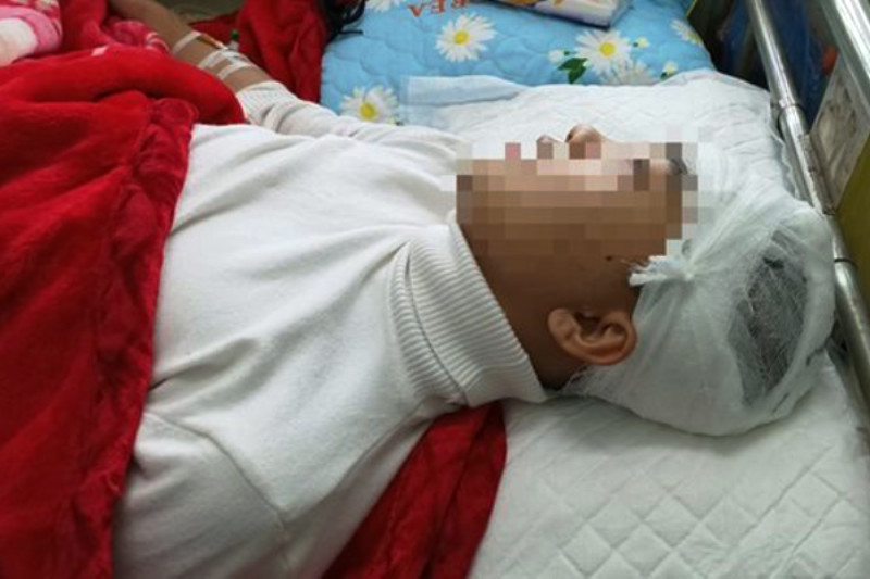 Phan Thanh L. bị đánh