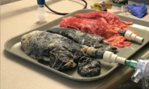 Thí nghiệm cho thấy sự khác biệt giữa phổi của người khỏe mạnh và người hút thuốc. Ảnh: A.E.