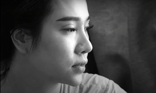 Chị Nhật lo lắng trước tình trạng viêm da cơ địa không được cải thiện