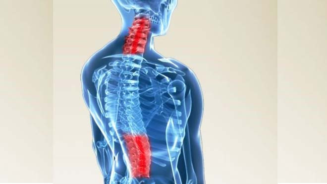 Thoái hóa cột sống thường gặp ở đốt sống cổ và thắt lưng.