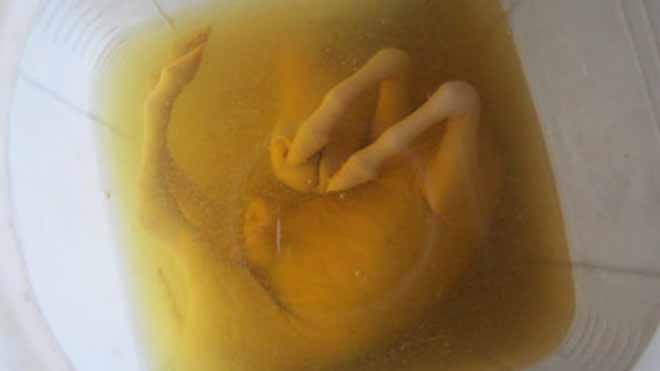 Bình rượu ngâm bào thai ngựa của ông Trí.