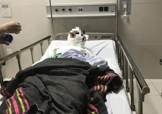 Nạn nhân đang được điều trị tại BV Hữu nghị Việt Nam - Cu Ba - Đồng Hới.