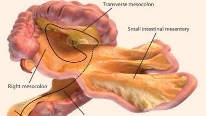 Nghiên cứu mới chứng minh màng treo ruột là một cơ quan liền khối. Ảnh: Đại học Bệnh viện Limerick.