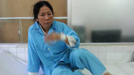 Nạn nhân Huỳnh Thị Hồng Tuyết đang điều trị tại BV Đà Nẵng.