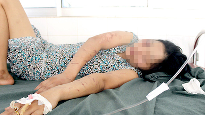 Ngoài những chấn thương trên cơ thể, chị Nguyễn Thị Kết còn bị sang chấn tâm lý.