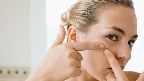 Không nên nặn mụn (ảnh minh họa)