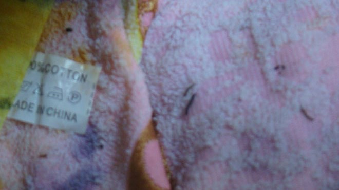 Ấu trùng 'đẻ' ra từ khăn tắm Trung Quốc là vô căn cứ