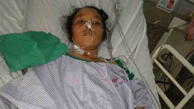 Bệnh nhân Giàng Thị Dủ. Ảnh: Bệnh viện cung cấp. 