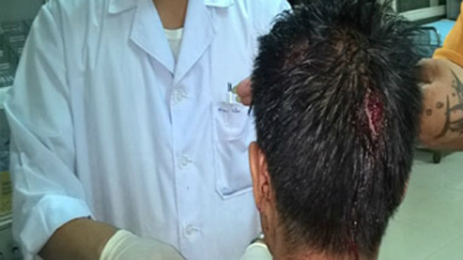 Anh Thịnh trọng thương sau "màn mưa dao kiếm". Ảnh: Lam Sơn.