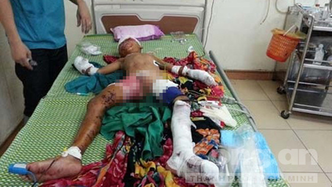 Hiện sức khỏe của cháu đang được theo dõi đặc biệt tại bệnh viện. Ảnh: Công an TP.HCM