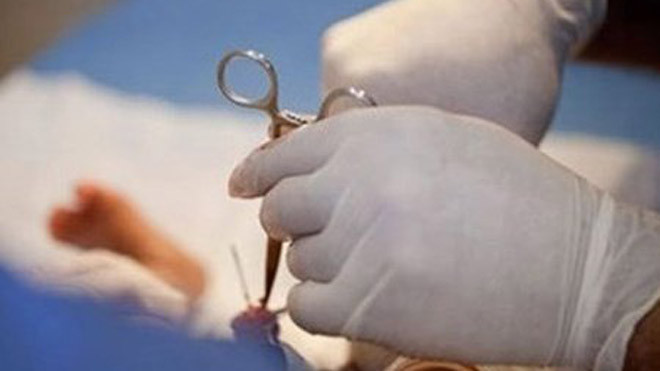 Không nên cắt bao quy đầu cho trẻ, tại sao?