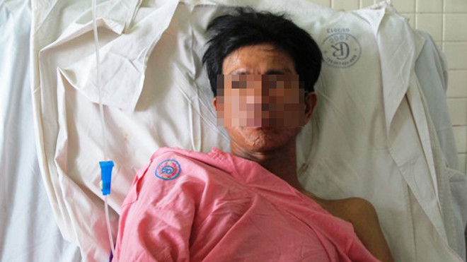 Sức khỏe bệnh nhân T. đã hồi phục