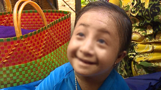 Thiếu nữ 16 tuổi nhưng mang hình hài như bé lên 3. Ảnh: Cửu Long