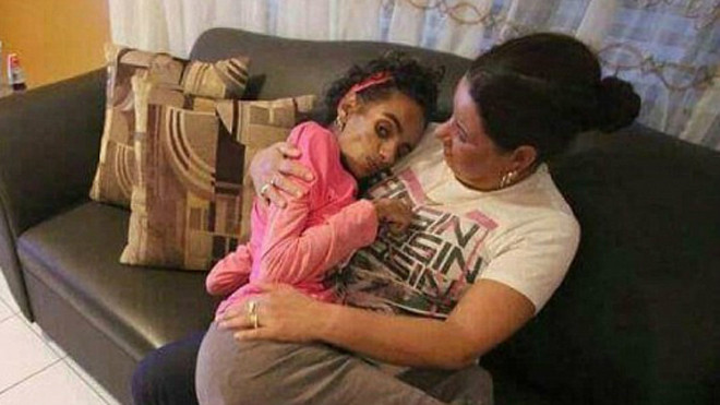 Ca phẫu thuật năm 2013 khiến Linda trở nên tàn tạ. Ảnh: GoFundMe.