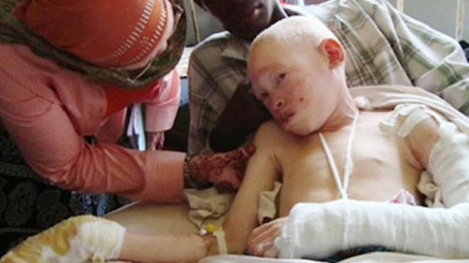 Người bạch tạng bị truy sát dã man