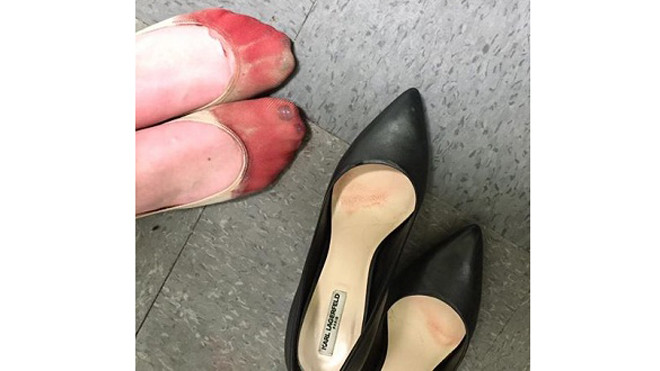 Một người bạn chụp ảnh đôi chân rướm máu của cựu nhân viên nhà hàng Joey đăng lên Facebook tuần trước. Ảnh: Facebook
