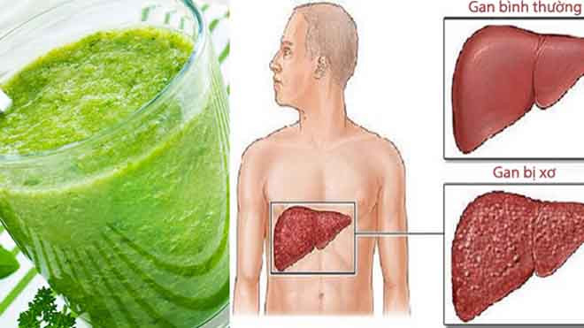 Lá gan phải xử lý một chuỗi hoạt động phức tạp để cơ thể khỏe mạnh.