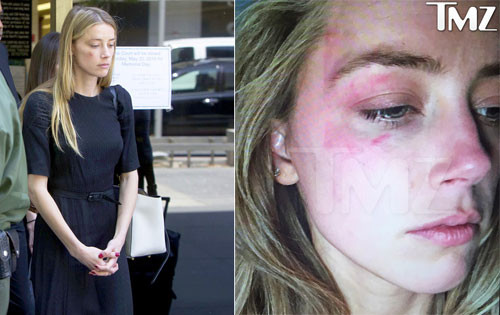 Gương mặt thâm tím của Amber Heard tại tòa án. Ảnh: TMZ, Splash.