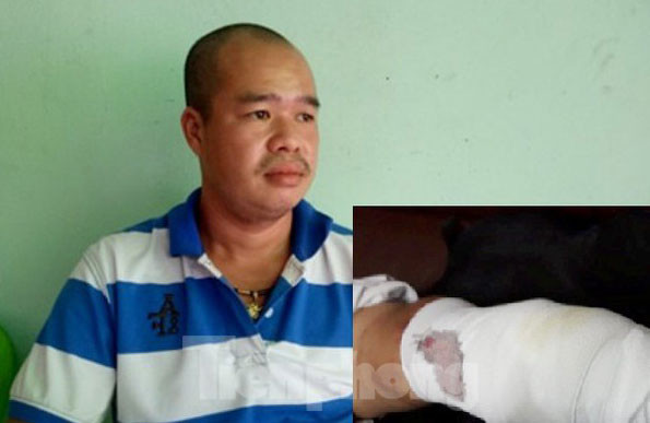 Lấy được tài sản cho người bị cướp, 'hiệp sĩ' bị đánh gãy chân