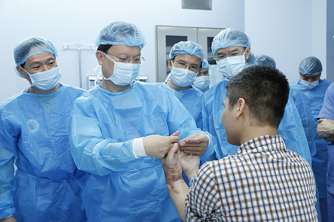 Tay ghép của bệnh nhân phục hồi tốt sau một tháng ghép, sáng 24/2. Ảnh: Đức Khánh.