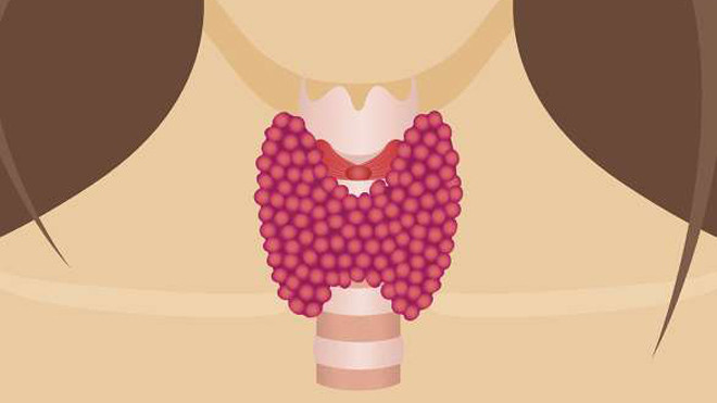 4 dấu hiệu ung thư tuyến giáp cần lưu ý