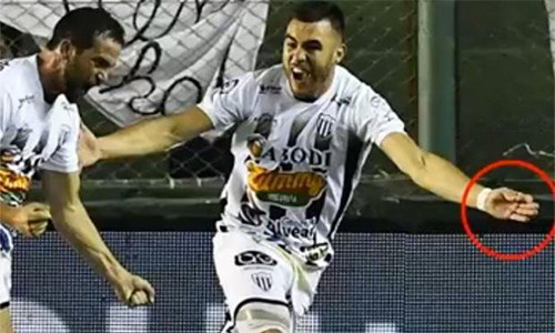 Dấu khoanh tròn được cho là chiếc kim mà Allende dùng để chích vào người Otero. Ảnh: Sun.