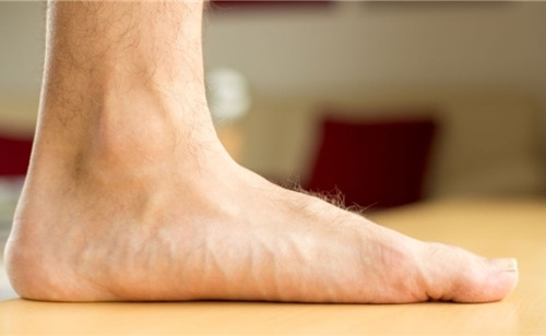 Lòng bàn chân của người bị bàn chân bẹt tiếp xúc trực tiếp với mặt đất.