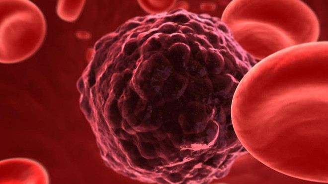 Những dạng ung thư không phải là án tử hình của cuộc đời