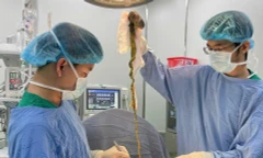 Lấy búi tóc khổng lồ ra khỏi dạ dày bé trai ở Đà Nẵng