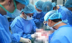 Ghép tạng ở Việt Nam đi sau thế giới gần 4 thập kỷ nhưng tiến bộ vượt bậc