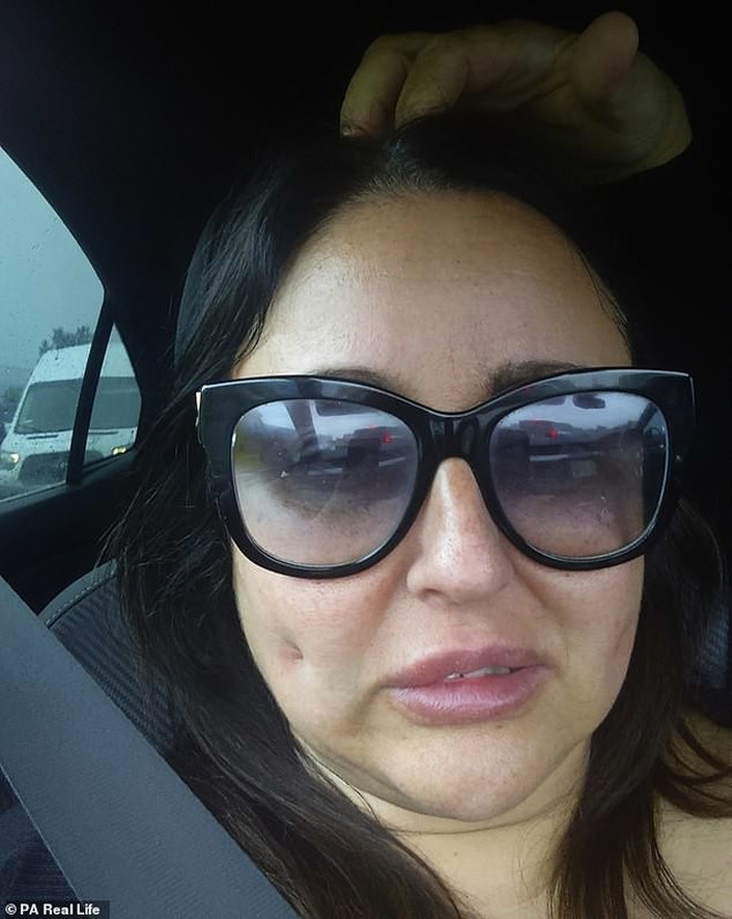 Bà Jo Martin đã có má lúm đồng tiền