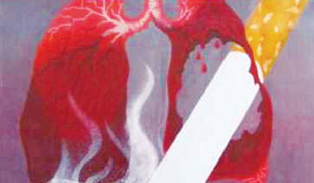 Hút thuốc lá là nguyên nhân của 90% các ca ung thư phổi.