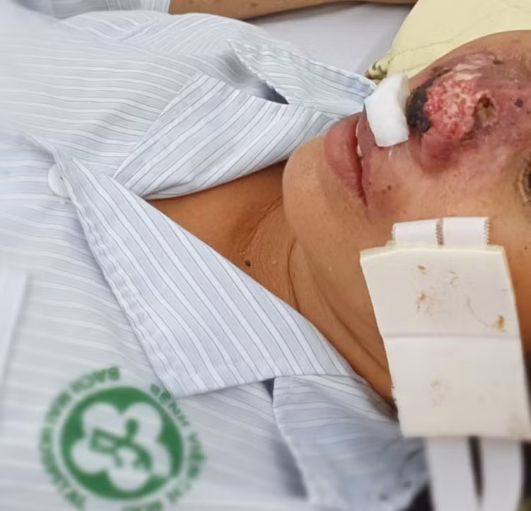 Cảnh báo bệnh truyền nhiễm nguy hiểm bùng phát