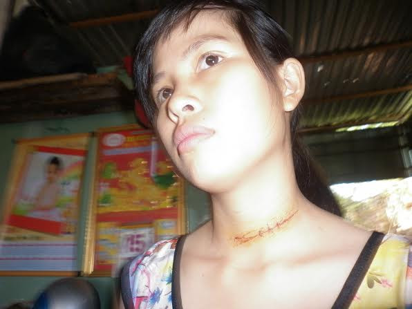 Vết cứa trên cổ nạn nhân. Ảnh: Trung Tính