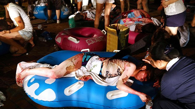 Đa số nạn nhân trong độ tuổi 20-30, có người bị bỏng đến độ da bị lột gần hết. Ảnh: Xinhua.