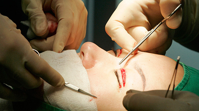 80% bác sỹ thẩm mỹ Hàn Quốc không có bằng