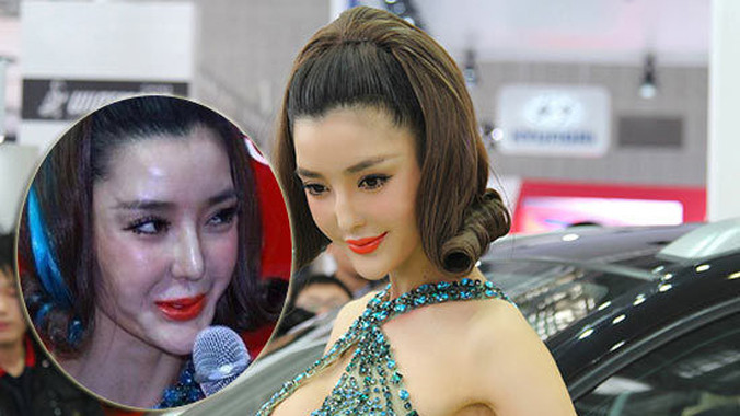 Ngôi sao Lý Dĩnh Chi trước và sau khi phẫu thuật thẩm mỹ.