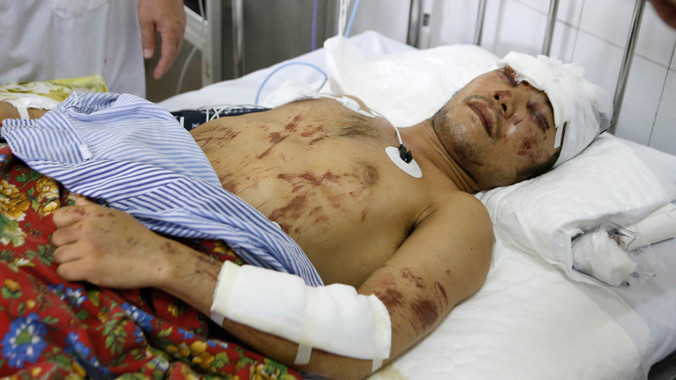 Nạn nhân Vỹ đang được điều trị tích cực. Ảnh: Minh Đức.