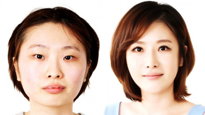 Thầy tướng Hàn Quốc bó tay vì nạn làm đẹp