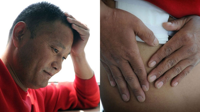 Ông Lưu Vĩnh Vĩ và vết mổ trên bụng.