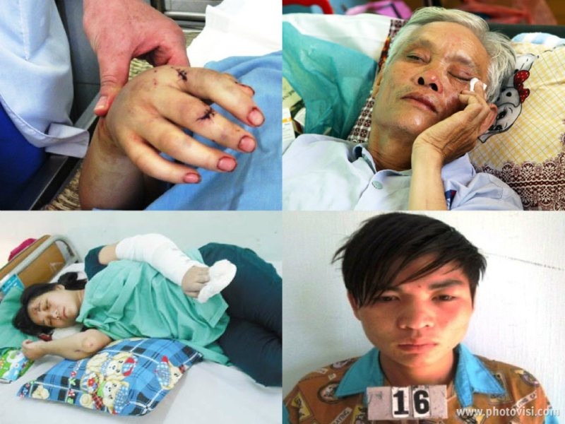 Bản tin Hình sự 18H: Bố chồng chém tới tấp vào con dâu mới sinh